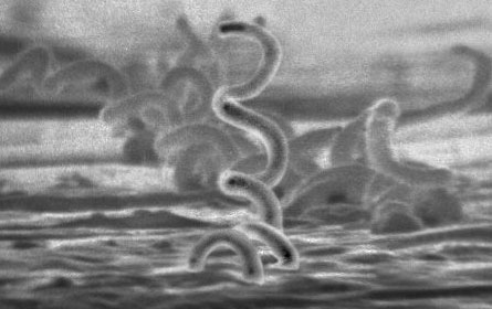 Image: syphilis bacteria